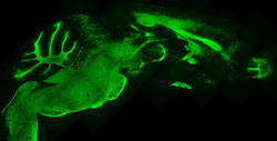 A section of Human glial progenitor cell-implanted shiverer mouse brain, immunolabeled for MBP.