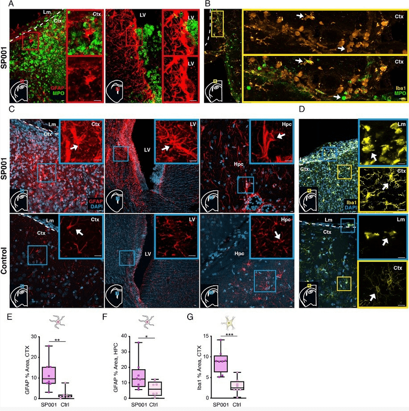 Streptococcus pneumoniae meningeal infection promotes gliosis in the brain parenchyma