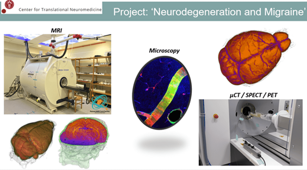 project neurodegeneration and migraine