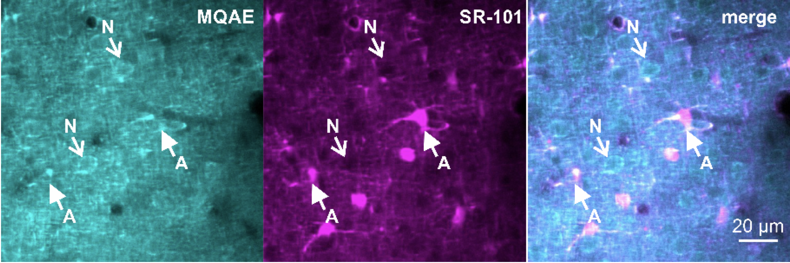 Astroglia and Neurons of cortex loaded MQAE (Cl- dye) in vivo. The Astroglial marker SR-101 labels Astroglia.