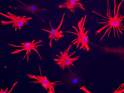 Astrocytes derived from an iPSC model of schizophrenia.