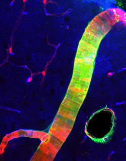 Large (green) and small (red) tracers tagged to soluble proteins in the paravascular cerebrospinal fluid.