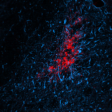 Ex vivo image of diffuse microinfarction induced by carotid artery infusion of cholesterol crystals. GFAP (Blue) indicates reactive astrocytes, CD68 (Red) indicates activated microglia.