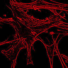 ATP released from fibroblasts after needle stimulation.