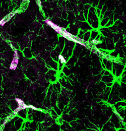 Astrocytes (green) with AQP4 expression on astrocytic end-feet (purple), surrounding cerebral vasculature (white).