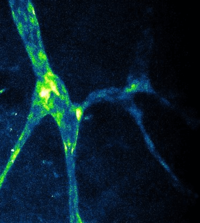 2-photon in-vivo image of lymphatic capillaries within the skin of the ear using a Proxy 1-eGFP mouse line