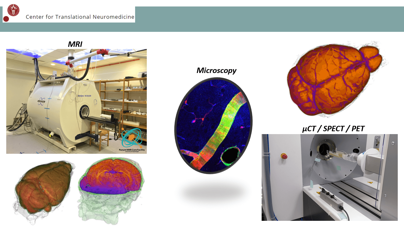 MSc projects focused on neuroimaging of the brains glymphatic system using mri and ct