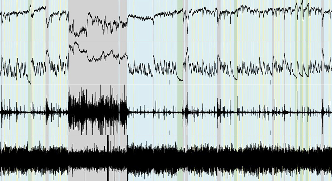 Division of Astrocyte driven Ionostasis