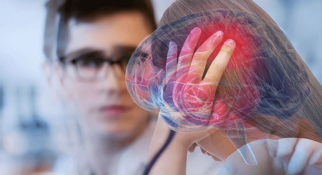 This is what drives the migraine headache